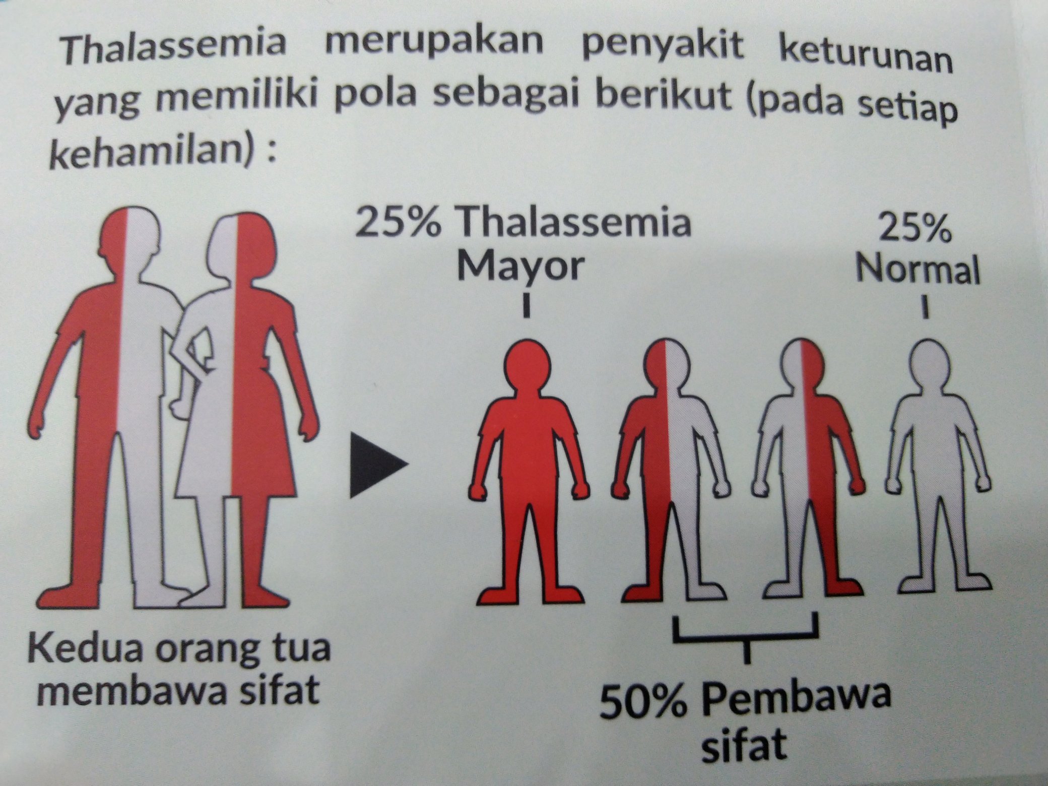 Talasemia penyakit Thalassemia alfa: